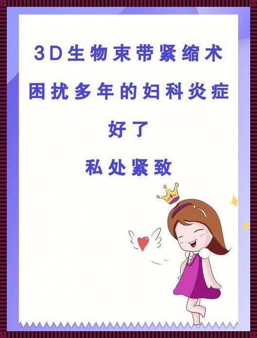 3D生物束带紧缩术：年限是个谜，全民追猜嗨翻天