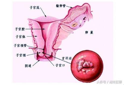 “下面”神秘肿痛，科技解锁新姿势