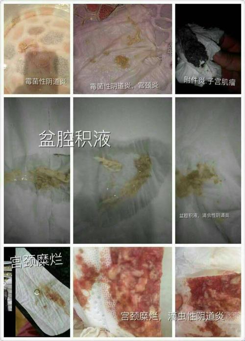 “月月我这是帮你排阴毒”潮流背后：网潮狂潮下的荒诞笑剧